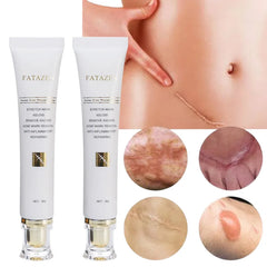Acne Scar Repair Cream – Advanced Scar Removal & Skin Repair Treatment for Stretch Marks, Keloids, Burns, and Acne Marks – Anti-Inflammatory & Moisturizing Formula – 30g