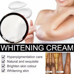 Dark Knees and Elbows Strong Whitening Cream