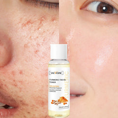 Turmeric Facial Toner - Natural Skin Treatment, 100ml