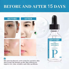 Pure Hyaluronic Acid Serum for Deep Hydration and Anti-Aging, 30ml