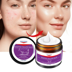 Whipped Tallow Balm - Pure Grass-Fed, Organic Moisturizing Cream for Face and Body
