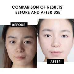 Vitamin C Serum 20% - Anti-Aging & Brightening Formula with Natural Antioxidants, Collagen & Hyaluronic Acid, Reduces Dark Spots & Wrinkles - 30ml/1.01 fl oz
