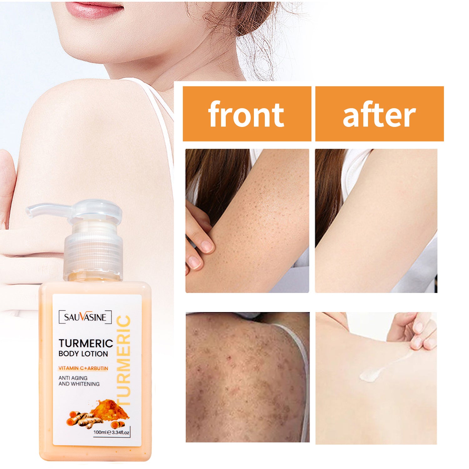 Turmeric Body Lotion - Anti-Aging & Whitening, Hydrating Body Lotion for All Skin Types - 100ml
