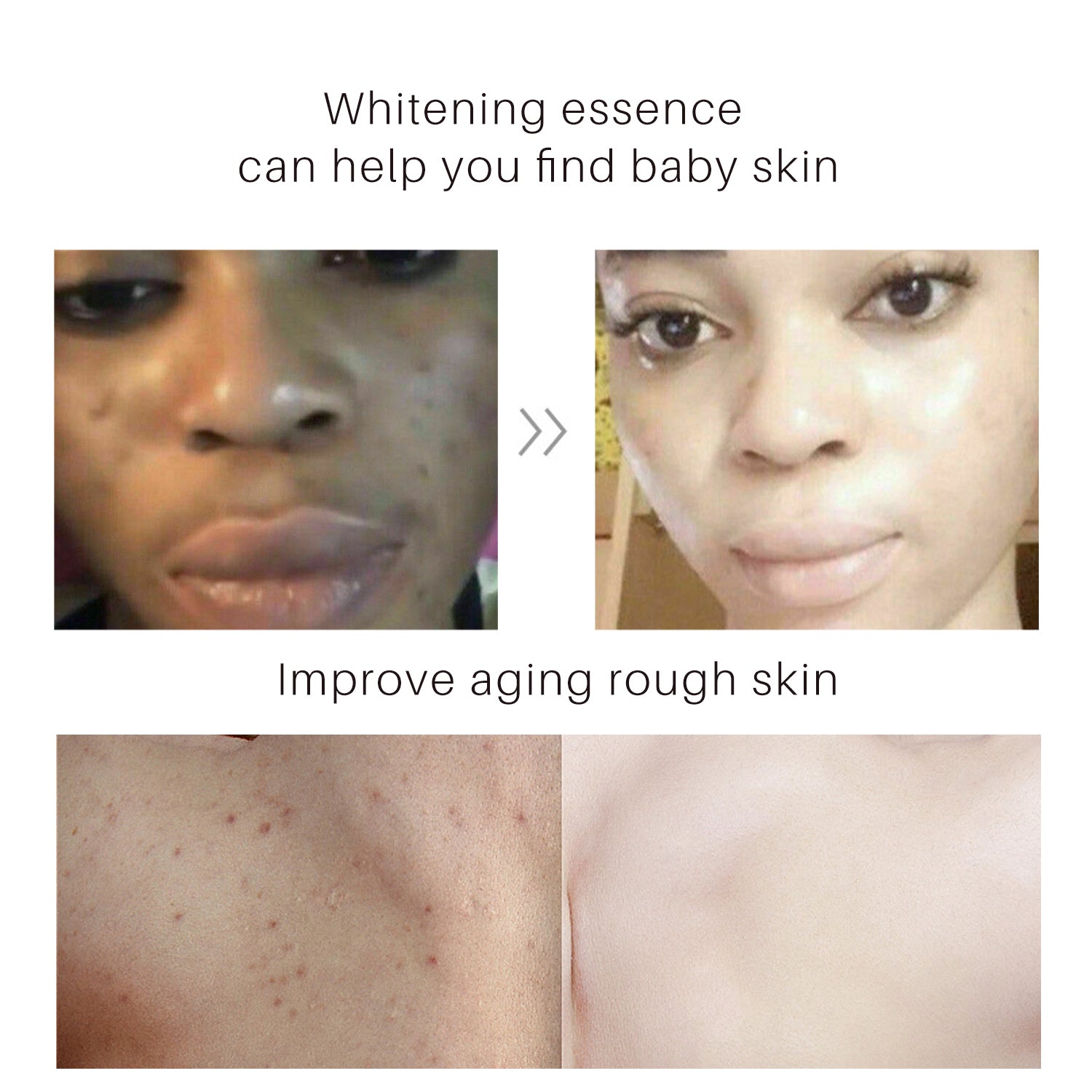 Turmeric Body Lotion - Anti-Aging & Whitening, Hydrating Body Lotion for All Skin Types - 100ml