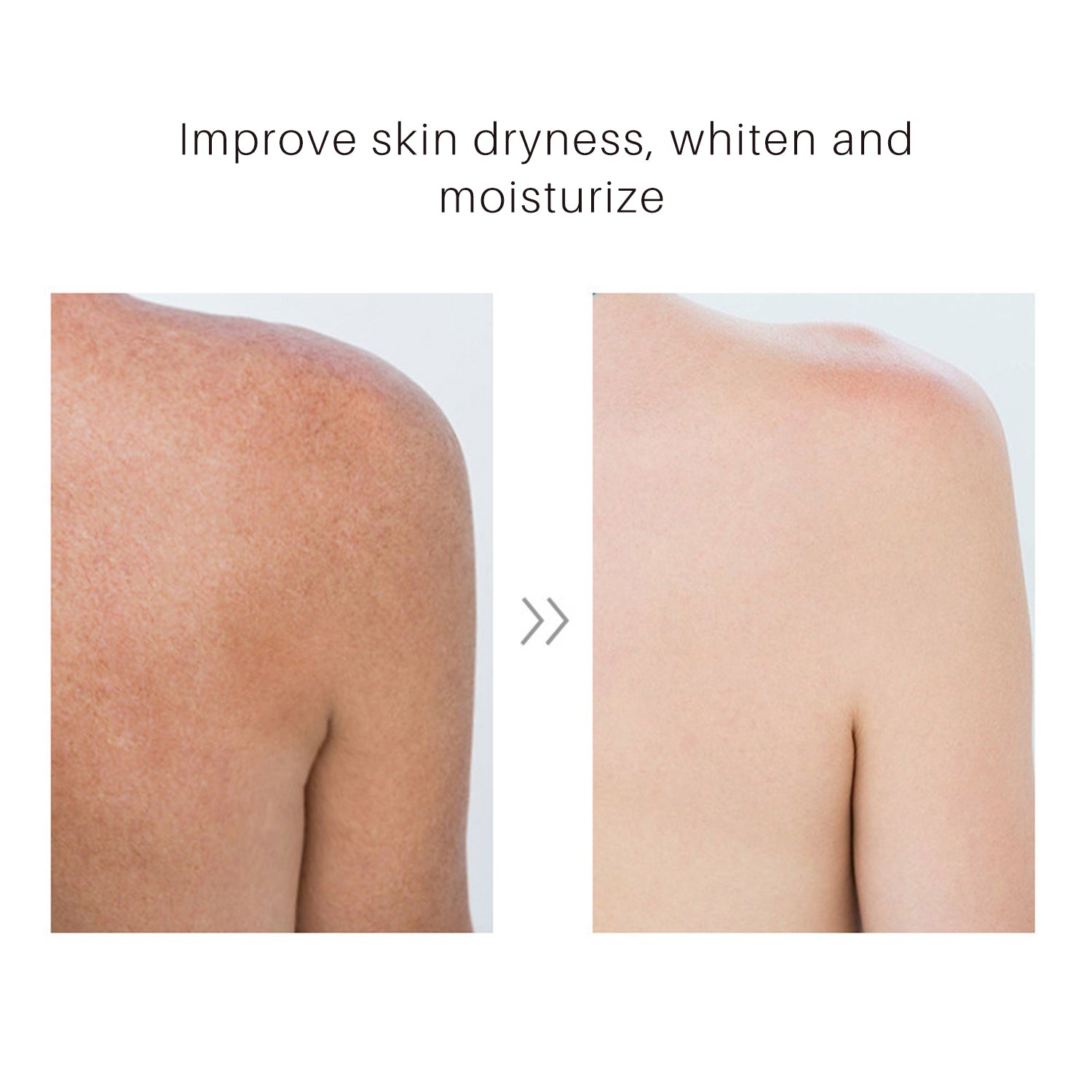 Turmeric Body Lotion - Anti-Aging & Whitening, Hydrating Body Lotion for All Skin Types - 100ml