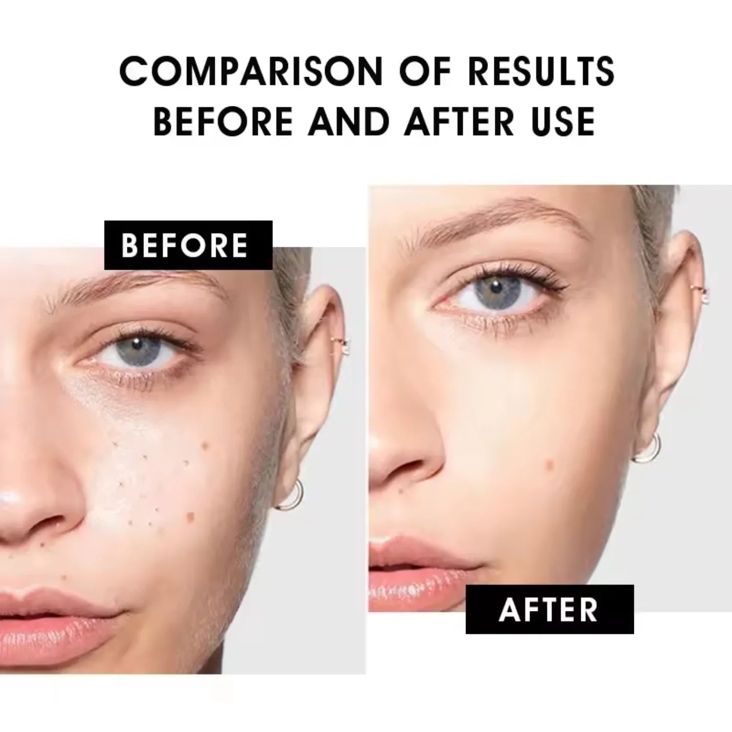 AHA + BHA Fruit Acid Serum - Natural Exfoliating and Brightening Skincare Formula, Reduces Acne and Fine Lines, Stimulates Collagen, 30ml