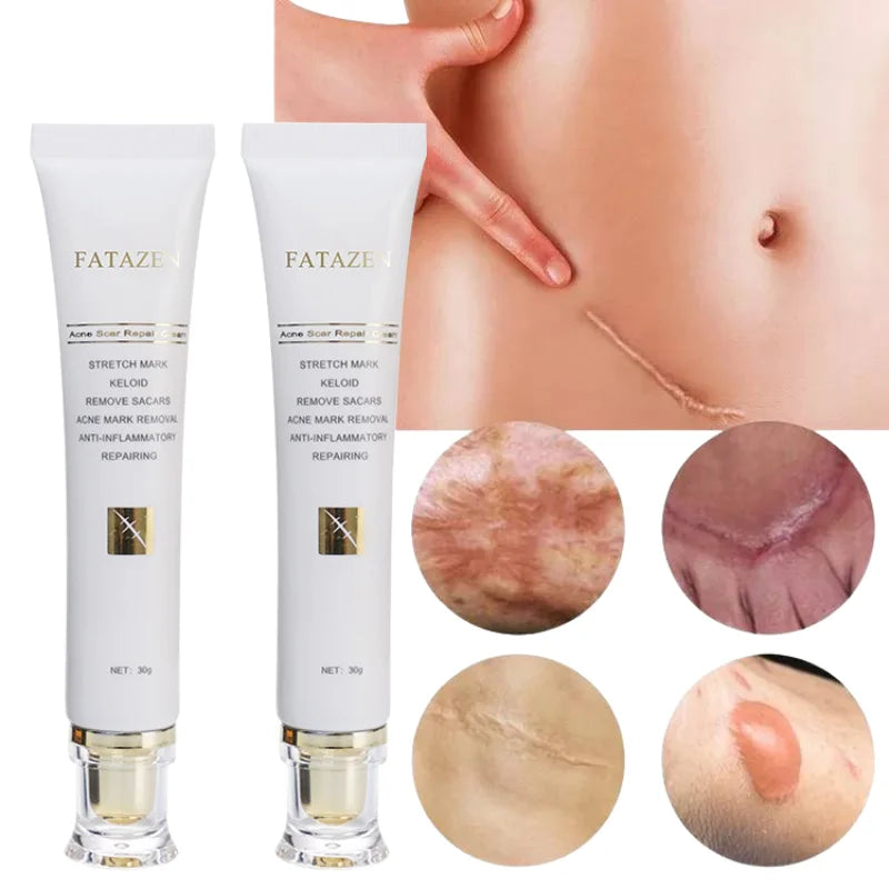 Acne Scar Repair Cream – Advanced Scar Removal & Skin Repair Treatment for Stretch Marks, Keloids, Burns, and Acne Marks – Anti-Inflammatory & Moisturizing Formula – 30g