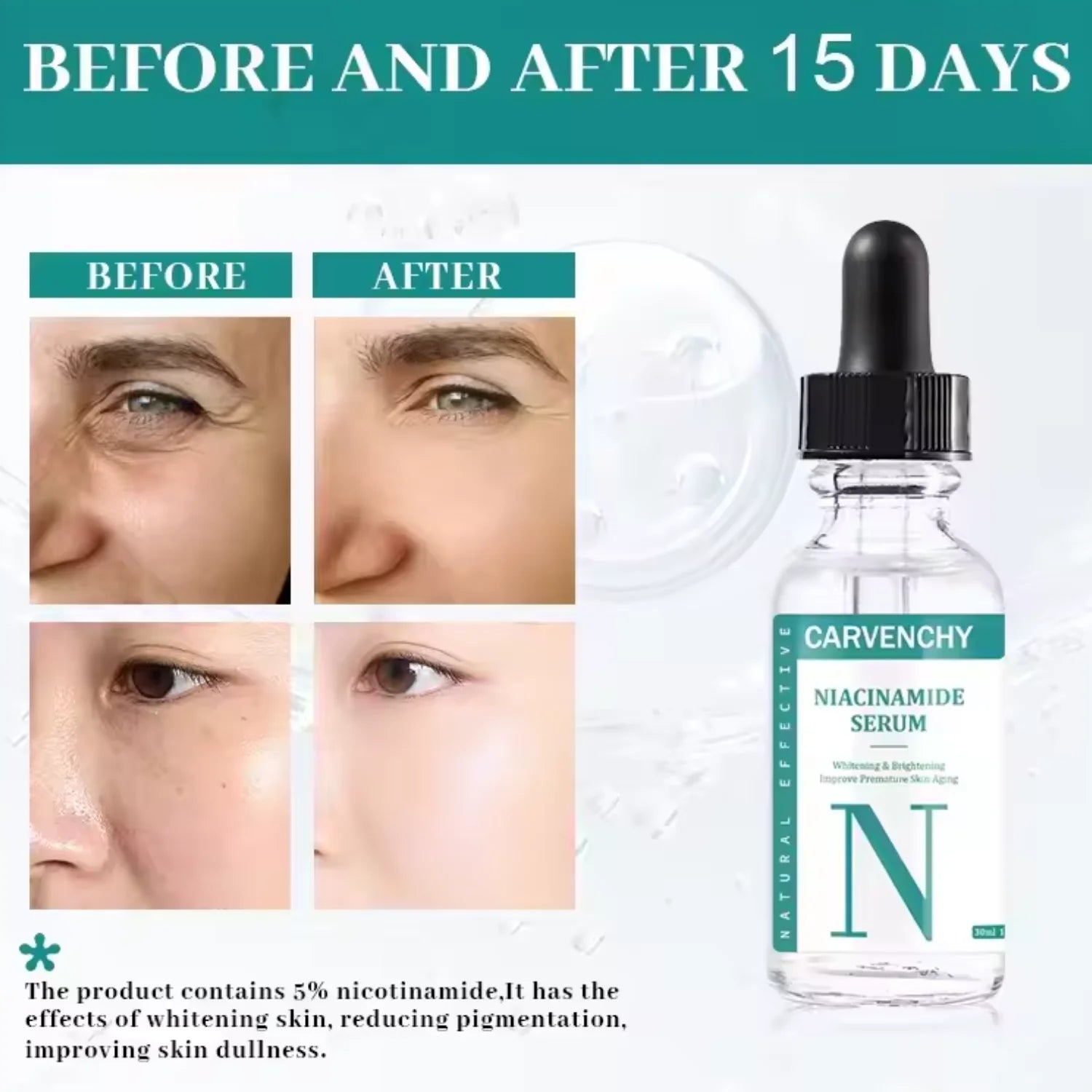 Niacinamide Serum - For Skin Brightening and Anti-Aging, 30ml