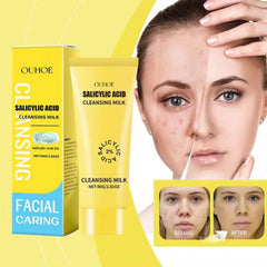 Salicylic Acid 2% Cleansing Milk - Deep Facial Cleanser for Acne-Prone Skin, Gentle Exfoliation, Oil Control, Pore Minimizer, and Skin Smoothing Formula