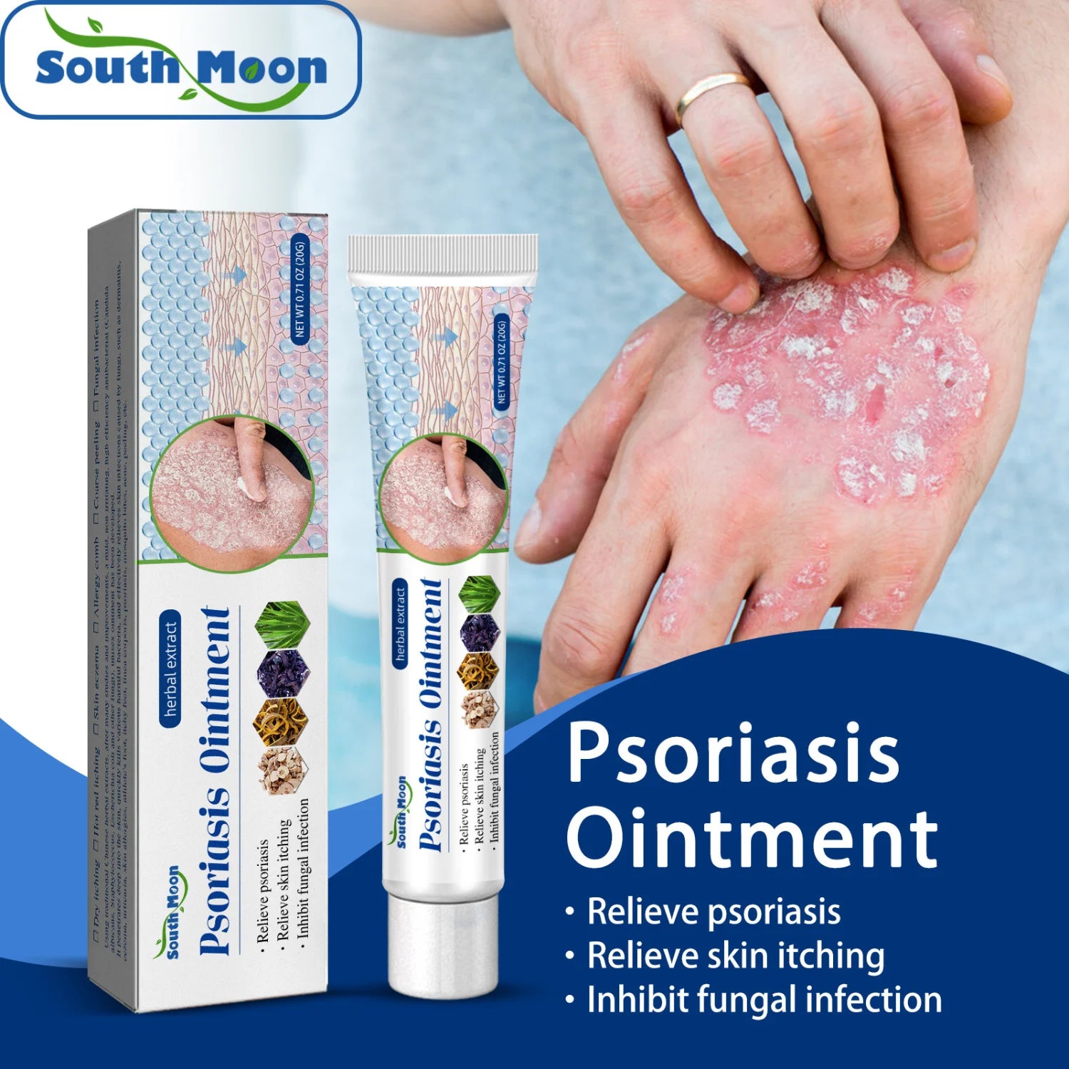 Britains Beauty Herbal Extract Psoriasis Ointment - Relieve Psoriasis, Itching & Fungal Infection - Safe, Non-Toxic, Deep Penetration
