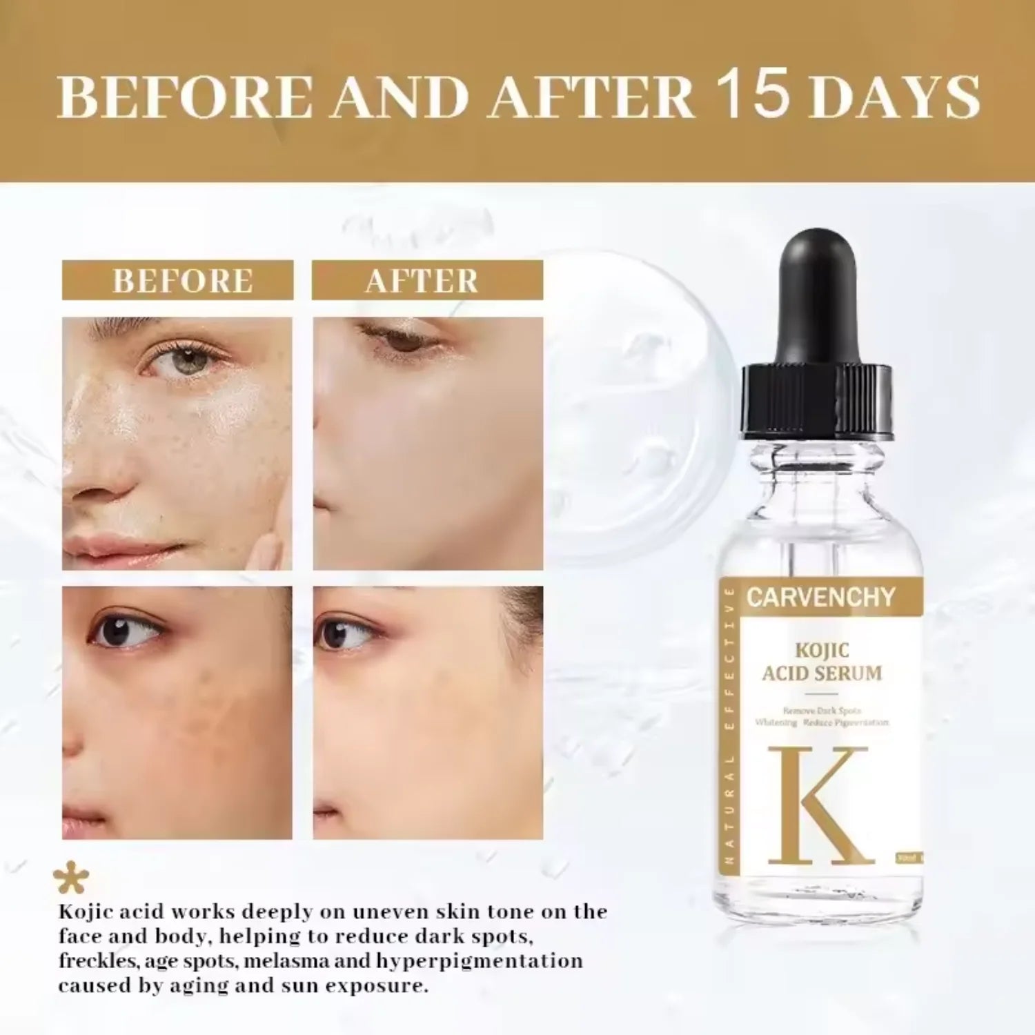 Kojic Acid Serum for Dark Spot Corrector & Skin Brightening, 30ml - Natural & Paraben Free