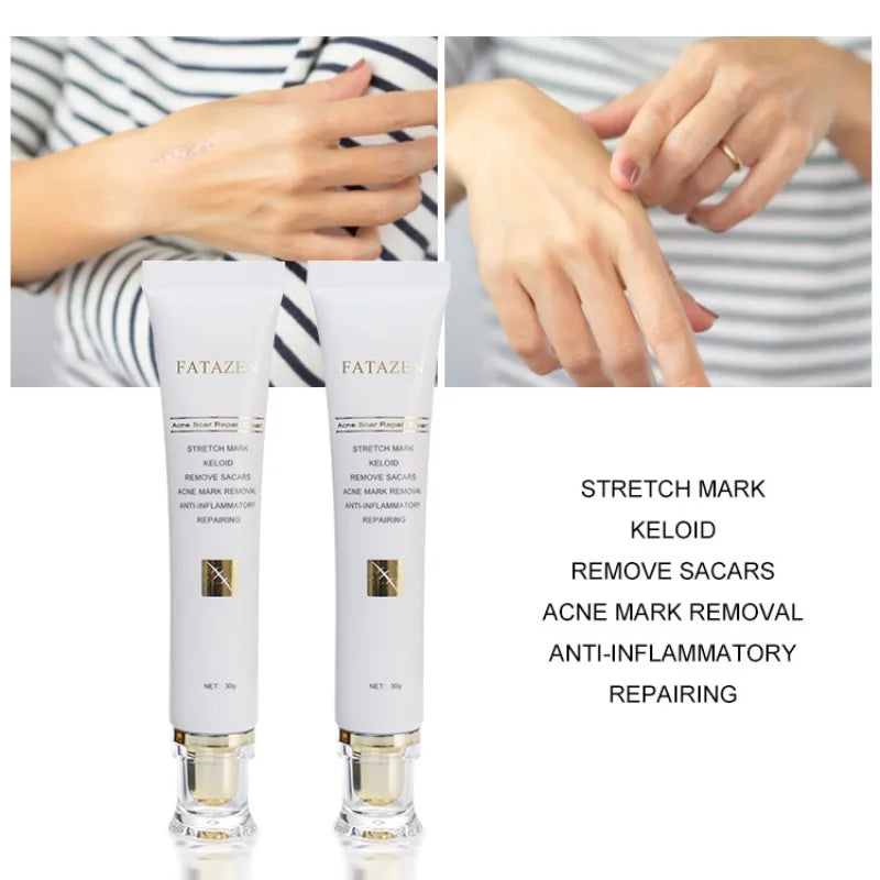 Acne Scar Repair Cream – Advanced Scar Removal & Skin Repair Treatment for Stretch Marks, Keloids, Burns, and Acne Marks – Anti-Inflammatory & Moisturizing Formula – 30g