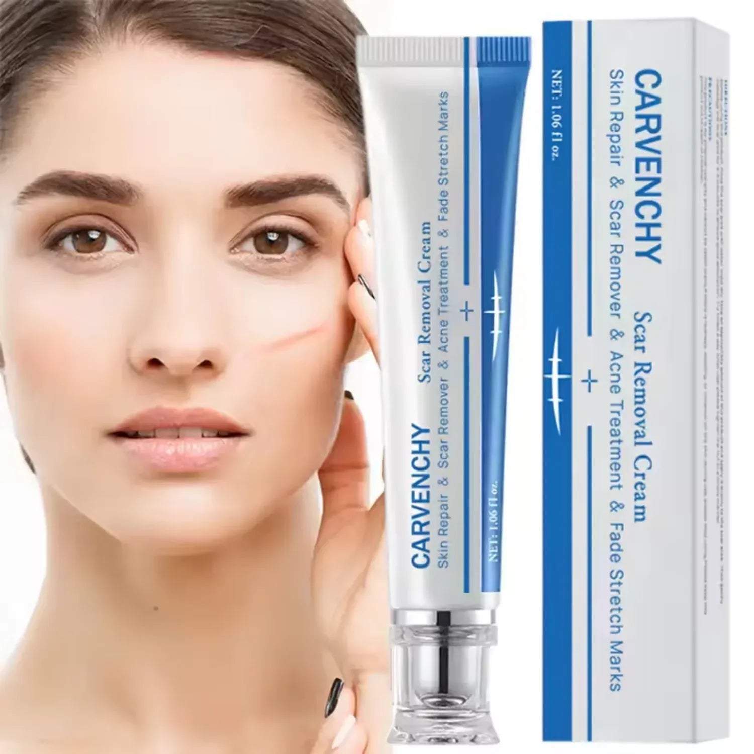 Advanced Scar Removal Cream - Effective Skin Repair for Surgical, Acne, and Stretch Marks