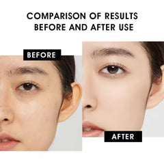 Turmeric Vitamin C Serum - Anti-Aging, Acne Treatment, Skin Brightening, For All Skin Types