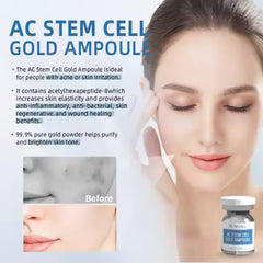 AC Stem Cell Gold Ampoule for Face – Anti-Wrinkle, Skin Repair, Anti-Aging Serum with Centella Asiatica & Acetyl Hexapeptide-8 – Boosts Elasticity, Heals Damaged Skin, Ideal for Microneedling