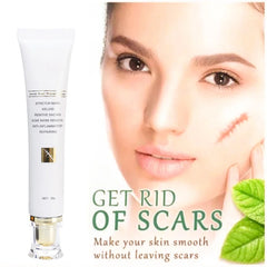 Acne Scar Repair Cream – Advanced Scar Removal & Skin Repair Treatment for Stretch Marks, Keloids, Burns, and Acne Marks – Anti-Inflammatory & Moisturizing Formula – 30g