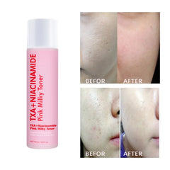 TXA + Niacinamide Pink Milky Toner for Face & Body – 2-in-1 Brightening & Hydrating Formula  – Even Tone & Smooth Texture